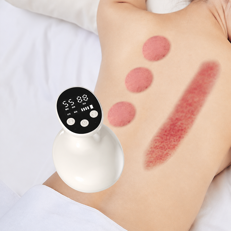 🧖‍♀️ Nouveauté 2026 – -50% 💮 Masseur Ventouses Chauffantes sous Vide🌿🏠